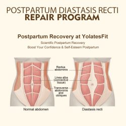 Postpartum Rectus tear Abdominis Tear Repair