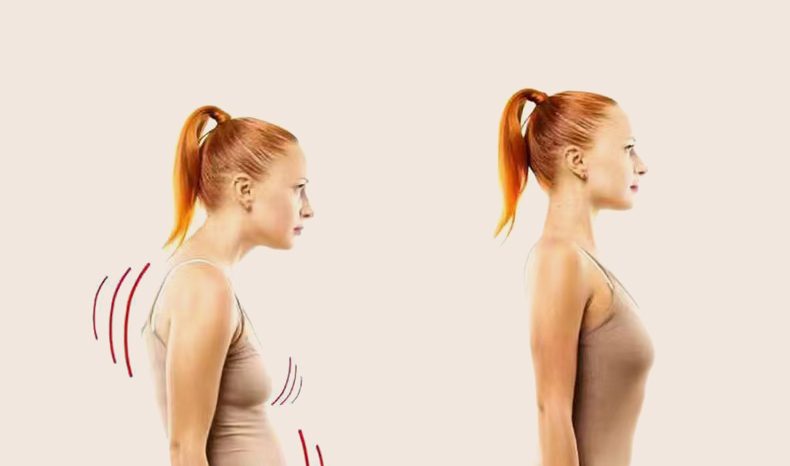 Hunchback Posture correction